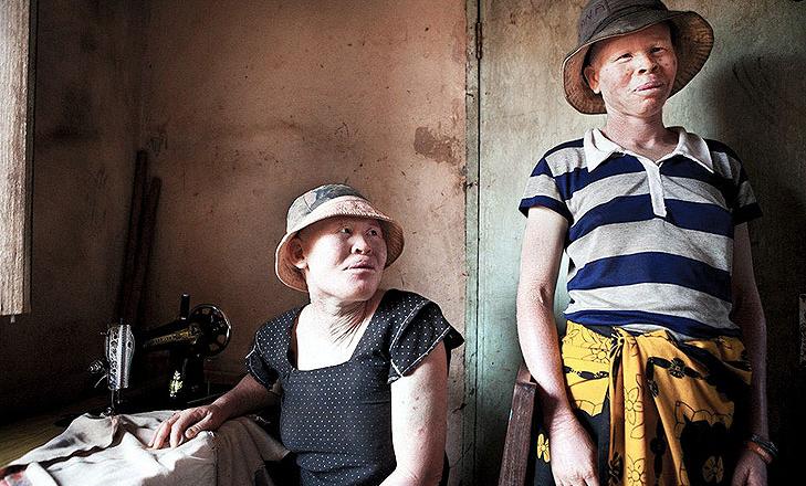 ana-palacios-albinos-07